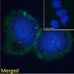 SLP-65 Antibody