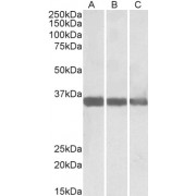 abx430083 (0.01 µg/ml) staining of Human (A), Mouse (B) and Rat (C) Heart lysate (35 µg protein in RIPA buffer). Primary incubation was 1 hour. Detected by chemiluminescence.