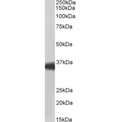 Malate Dehydrogenase 1 (MDH1) Antibody