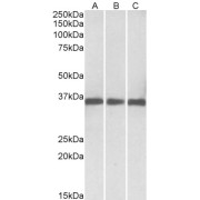 abx430084 (0.03 µg/ml) staining of Human (A), Mouse (B) and Rat (C) Heart lysates (35 µg protein in RIPA buffer). Primary incubation was 1 hour. Detected by chemiluminescence.