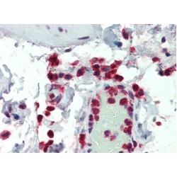 Neutrophil Cytosolic Factor 1 (NCF1) Antibody