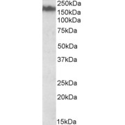 abx430087 (0.03 µg/ml) staining of Mouse Brain lysate (35 µg protein in RIPA buffer). Detected by chemiluminescence.