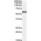 P2X Purinoceptor 4 (P2X4) Antibody