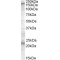 Sulfonylurea Receptor 1 (SUR1) Antibody