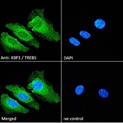 X-Box-Binding Protein 1 (XBP1) Antibody