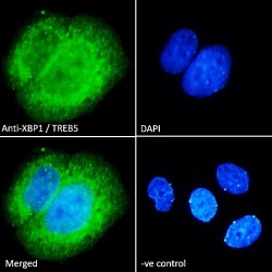 X-Box-Binding Protein 1 (XBP1) Antibody