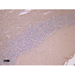 Fasciculation And Elongation Protein Zeta-1 (FEZ1) Antibody