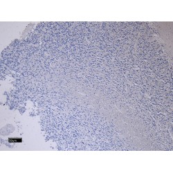 Fasciculation And Elongation Protein Zeta-1 (FEZ1) Antibody