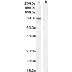 Fasciculation And Elongation Protein Zeta-1 (FEZ1) Antibody