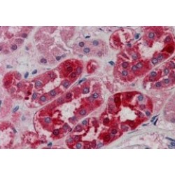 Probable E3 Ubiquitin-Protein Ligase MID2 (MID2) Antibody