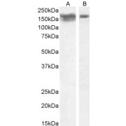 Western blot analysis of Human Frontal Cortex (A) and Cerebellum (B) lysate (35 µg protein in RIPA buffer) using NCAM1 antibody ((A): 0.01 µg/ml, (B): 0.1 µg/ml).