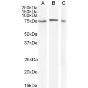 HEK293 lysate (10 µg protein in RIPA buffer) overexpressing Human MAP3K7 with DYKDDDDK tag probed with abx430125 (1 µg/ml) in Lane A and probed with anti- DYKDDDDK Tag (1/3000) in lane C. Mock-transfected HEK293 probed with abx430125 (1mg/ml) in Lane B. Detected by chemiluminescence.