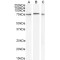 Mitogen-Activated Protein Kinase Kinase Kinase 7 (MAP3K7) Antibody