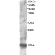 abx430134 staining (1 µg/ml) of HepG2 lysate (RIPA buffer, 30 µg total protein per lane). Primary incubated for 1 hour. Detected by chemiluminescence.