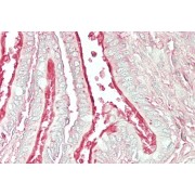 abx430142 (5 µg/ml staining of paraffin embedded Human Lung. Steamed antigen retrieval with citrate buffer pH 6, AP-staining.
