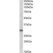 abx430147 (1 µg/ml) staining of Human Skeletal Muscle lysate (35 µg protein in RIPA buffer). Primary incubation was 1 hour. Detected by chemiluminescence.