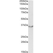 abx430155 (0.5 µg/ml) staining of Human Heart lysate (35 µg protein in RIPA buffer) with (B) and without (A) blocking with the immunising peptide. Primary incubation was 1 hour. Detected by chemiluminescence.