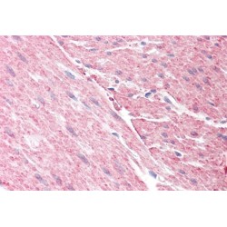 Rho GTPase-Activating Protein 26 (ARHGAP26) Antibody