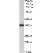 abx430172 (2 µg/ml) staining of Kelly lysate (35 µg protein in RIPA buffer). Primary incubation was 1 hour. Detected by chemiluminescence.