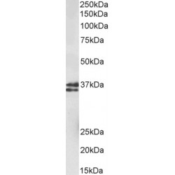 RNA-Binding Protein Musashi Homolog 2 (MSI2) Antibody