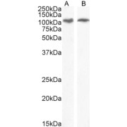abx430175 (0.3 µg/ml) staining of Human Duodenum (A) and (0.1 µg/ml) Pancreas (B) lysate (35 µg protein in RIPA buffer). Detected by chemiluminescence.