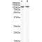 Endoplasmic Reticulum To Nucleus Signalling 1 (ERN1) Antibody