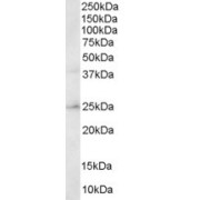 abx430181 staining (0.3 µg/ml) of Human Brain lysate (RIPA buffer, 30 µg total protein per lane). Detected by chemiluminescence.