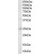 Amyloid B-Peptide-Binding Alcohol Dehydrogenase (ABAD) Antibody