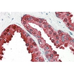 Prostatic Acid Phosphatase (ACPP) Antibody