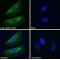 Alanine Glyoxylate Aminotransferase (AGXT) Antibody