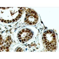 Apurinic-Apyrimidinic Endonuclease 1 (APE1) Antibody