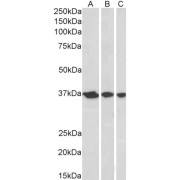 abx430192 (0.3 µg/ml) staining of A431 (A), HeLa (B) and MCF7 (C) nuclear lysates (35 µg protein in RIPA buffer). Primary incubation was 1 hour. Detected by chemiluminescence.