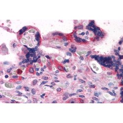 Bcl2 Associated Athanogene 3 (BAG3) Antibody