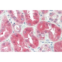 Dehydrogenase/reductase SDR Family Member 6 (DHRS6) Antibody