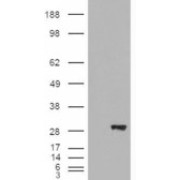 HEK293 overexpressing BDH2 and probed with abx430196 (mock transfection in first lane).