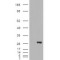 Dehydrogenase/reductase SDR Family Member 6 (DHRS6) Antibody