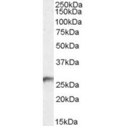 Dehydrogenase/reductase SDR Family Member 6 (DHRS6) Antibody