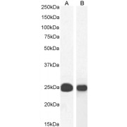 abx430197 (0.03 µg/ml) staining of A43N (A) and K562 (B) cell lysate (35 µg protein in RIPA buffer). Detected by chemiluminescence.