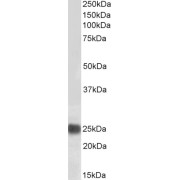 Biotinylated abx430197 (0.1 µg/ml) staining of HeLa lysate (35 µg protein in RIPA buffer). Primary incubation was 1 hour. Detected by chemiluminescence, using streptavidin-HRP and using NAP blocker as a substitute for skimmed milk.