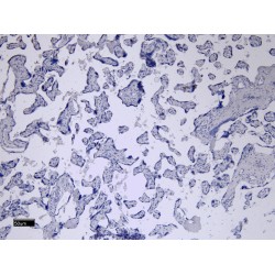 Low Affinity Immunoglobulin Gamma Fc Region Receptor II-B (FCGR2B) Antibody