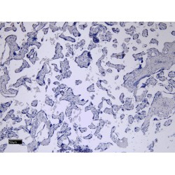 Fc Fragment of IgG, Low Affinity IIb, Receptor For (CD32) (FCGR2B) Antibody