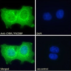 Pleckstrin Homology Sec7 And Coiled-Coil Domains-Binding Protein (PSCDBP) Antibody