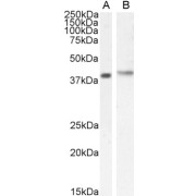 abx430215 (1.0 µg/ml) staining of MOLT4 (35 µg protein in RIPA buffer). Primary incubation was 1 hour. Detected by chemiluminescence.