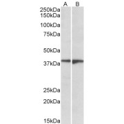 abx430219 (1 µg/ml) staining of Human Frontal Cortex (A) and Amygdala (B) lysates (35 µg protein in RIPA buffer). Primary incubation was 1 hour. Detected by chemiluminescence.