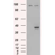HEK293 overexpressing ELF3 and probed with abx430220 (mock transfection in first lane).