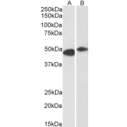 abx430226 (0.3 µg/ml) staining of Human Frontal Cortex (A) and Rat (B) Brain lysate (35 µg protein in RIPA buffer). Detected by chemiluminescence