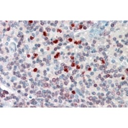 Arachidonate 5-Lipoxygenase-Activating Protein (ALOX5AP) Antibody