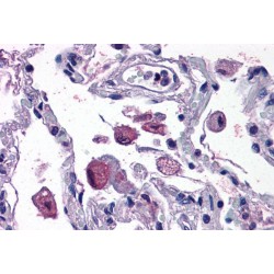 Arachidonate 5-Lipoxygenase-Activating Protein (ALOX5AP) Antibody