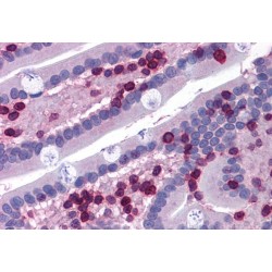 Arachidonate 5-Lipoxygenase-Activating Protein (ALOX5AP) Antibody