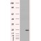 Glutathione S-Transferase P (GSTP1) Antibody